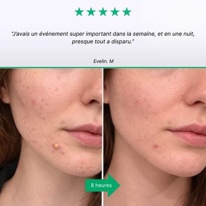 SOS Boutons DerGo - Mode d'emploi application sur bouton